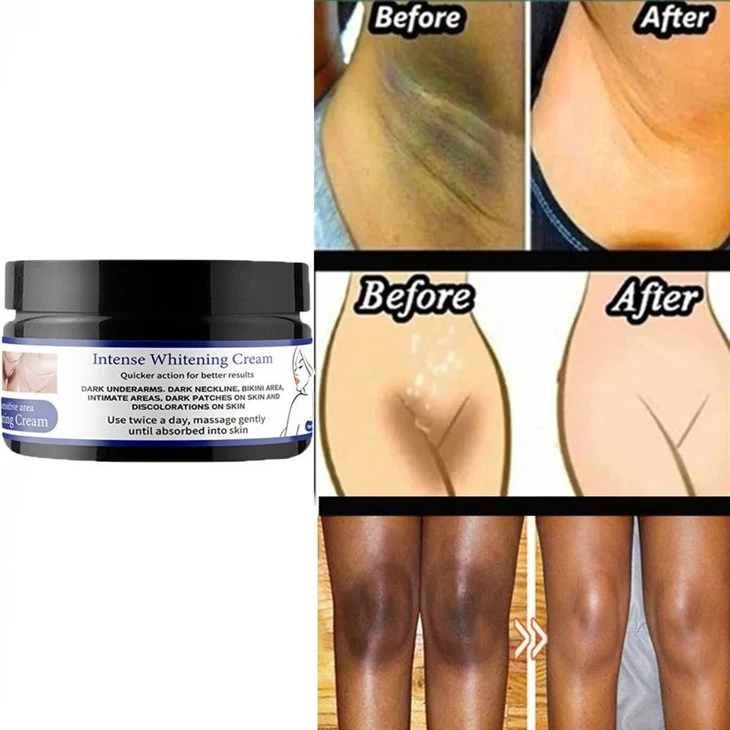 Mooyam Intense Whitening Cream